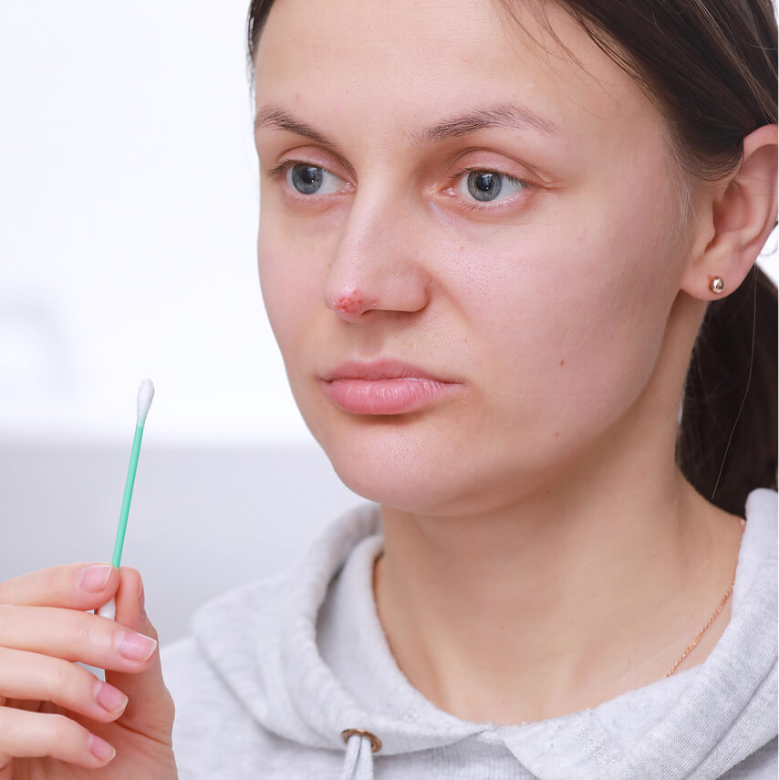 herpes-on-the-nose-pretty-young-woman-woman-hold-2024-10-18-09-31-12-utc (1)